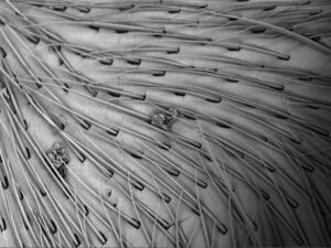 Scanning electron microscopy of insect hairs