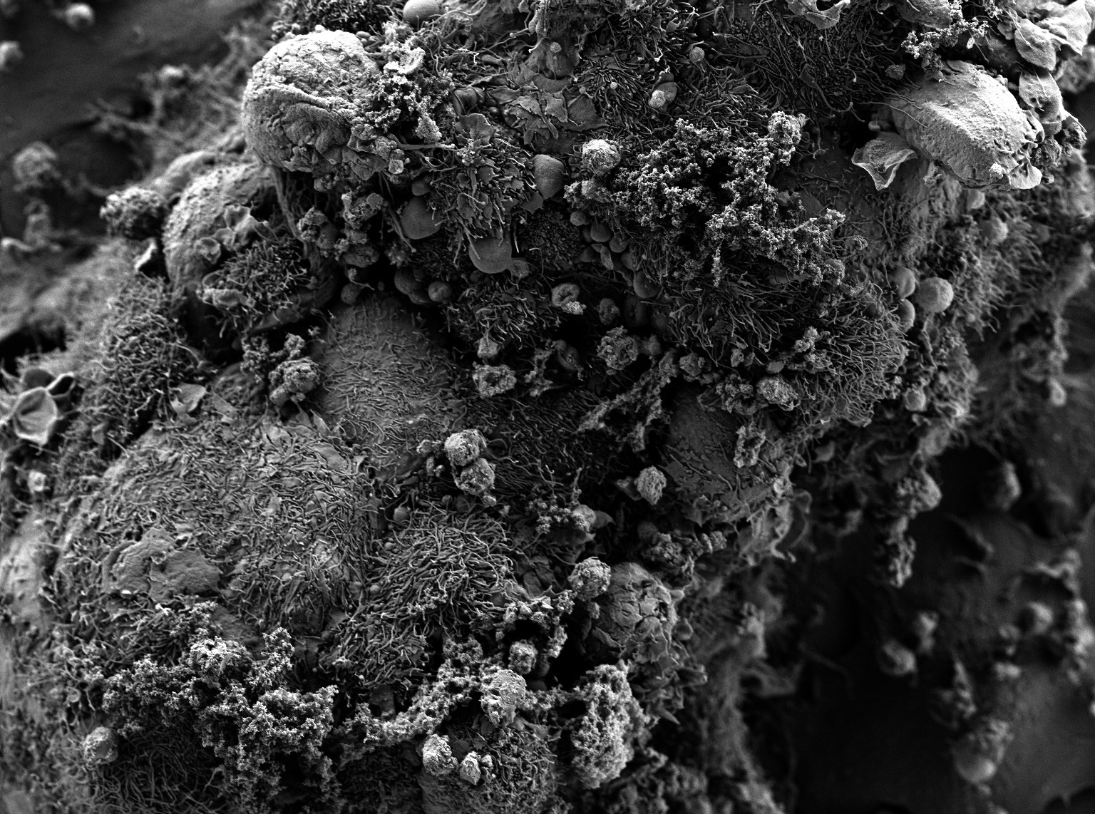 Scanning electron microscopy of mesenchymal stem cell spheroids