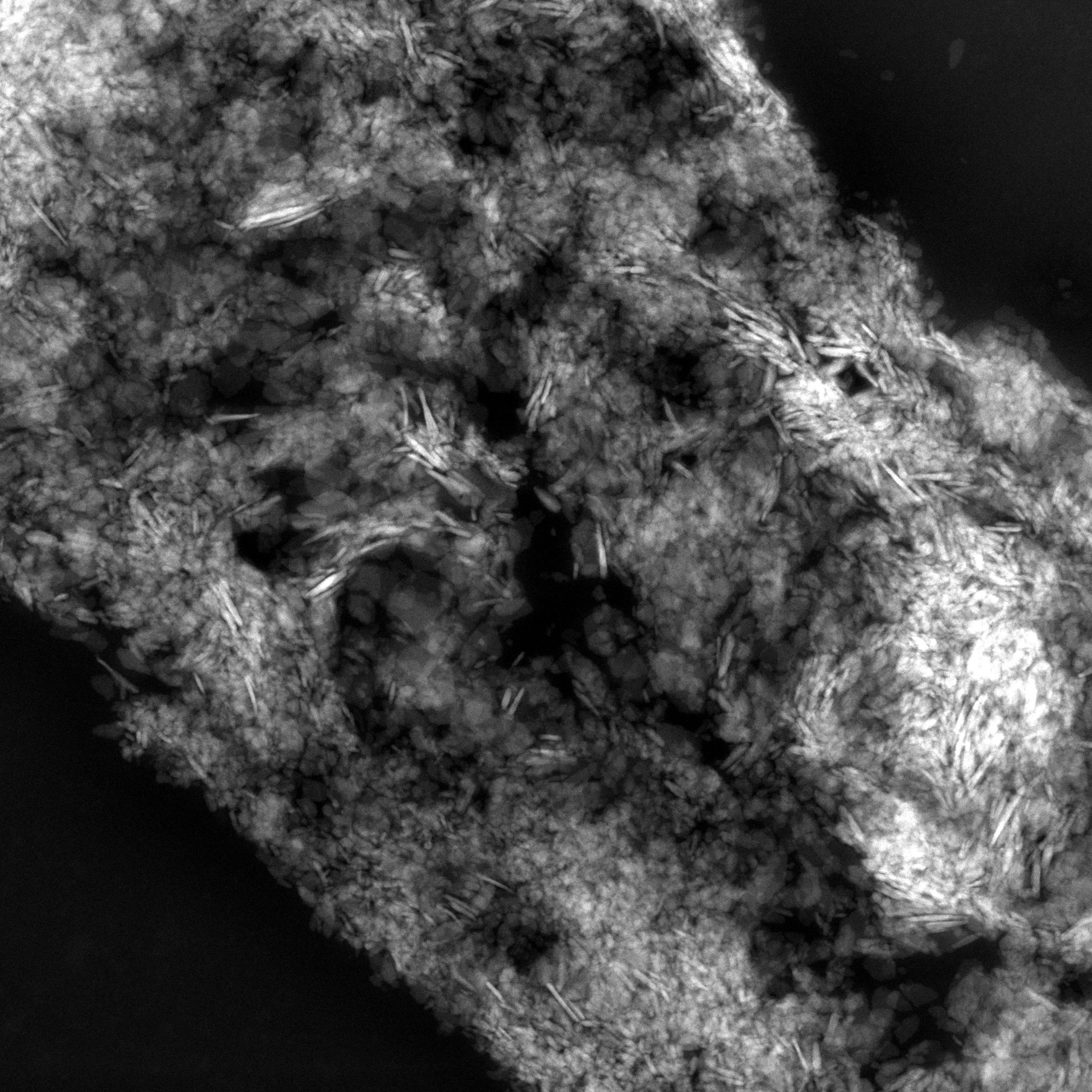 Scanning transmission electron microscopy of a human bone biopsy section