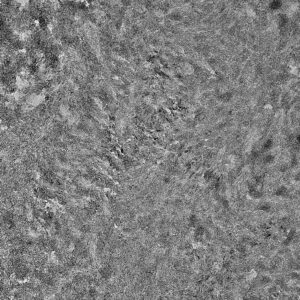 Transmission electron microscopy in an unstained human bone biopsy section