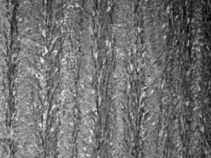 Transmission electron microscopy of decalcified mouse lamellar bone