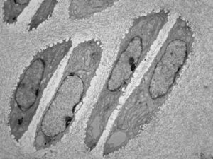 Transmission electron microscopy of mouse growth plate cartilage chondrocytes