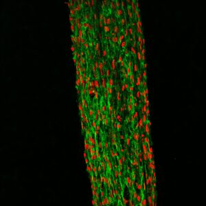Confocal microscopy of a fibrin construct showing collagen (green) and cell nuclei (red)