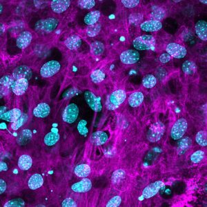 Confocal microscopy of MC3T3 cells showing collagen fibres (purple) and cell nuclei (teal)