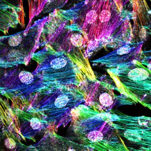 Orientation analysis of actin filaments in MC3T3 cells