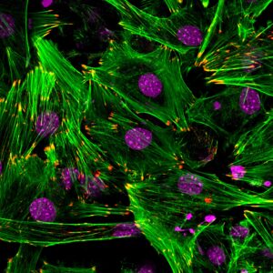 Confocal microscopy of focal adhesions (red), actin filaments (green) and cell nuclei (purple) in MC3T3 cells