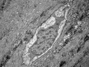 Transmission electron microscopy of an osteocyte in decalcified mouse lamellar bone